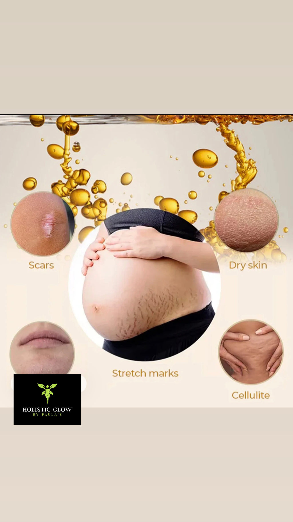 Olive Smoothing oil for stretch marks.
150ml