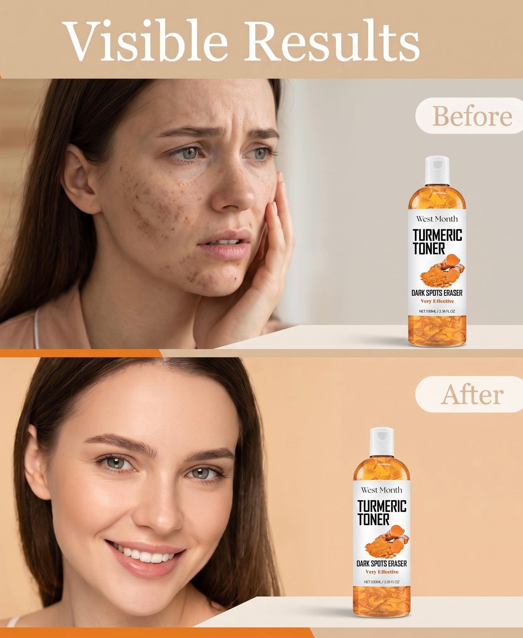 Before-and-after comparison showing a woman's face with freckles and dark spots in the top panel and clear, even skin in the bottom panel, alongside a bottle of West Month's Turmeric Toner labeled 'Dark Spot Savior'.