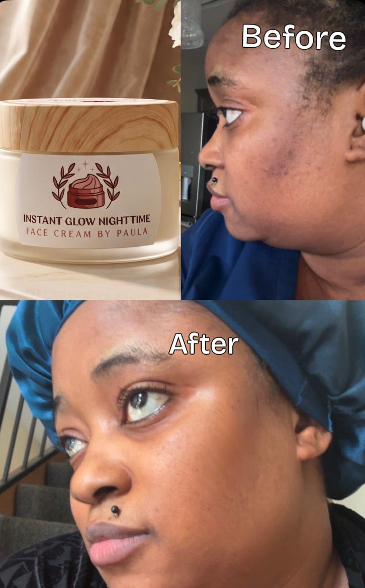 Instant Glow Nighttime Face Cream by Paula’s - SPF 15, Corrects Dark Spots, Acne Scars, Dark Circles, Glow Finish for Oily Skin
