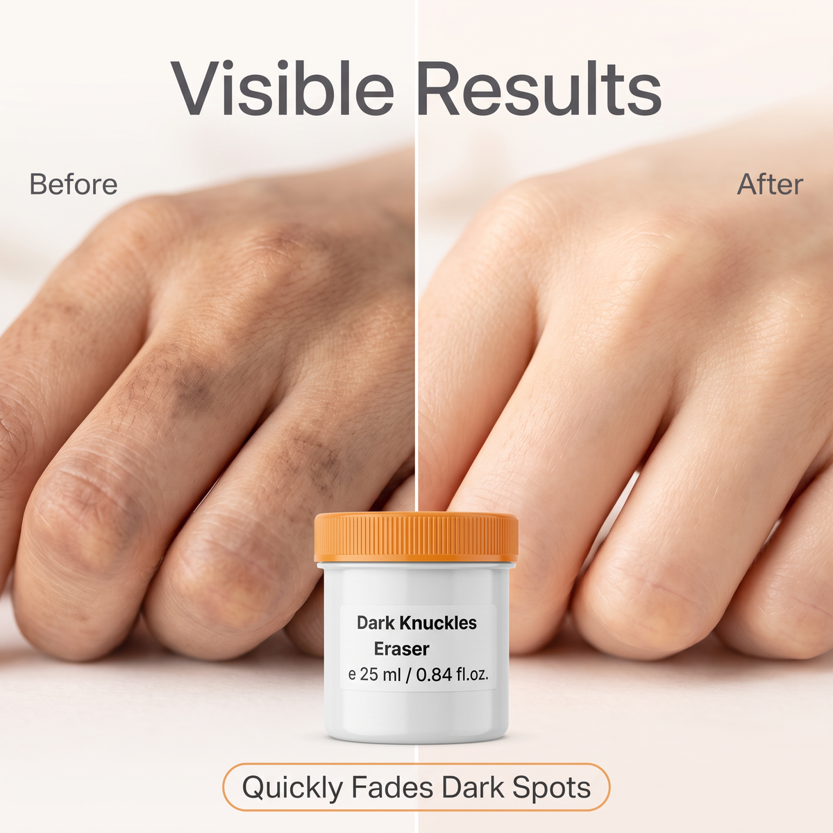 A split-screen before-and-after graphic showing hands with dark bruising on the left and clearer skin on the right, with the text 'Visible Results' at the top and a small jar labeled 'Dark Knuckles Eraser' at the bottom.