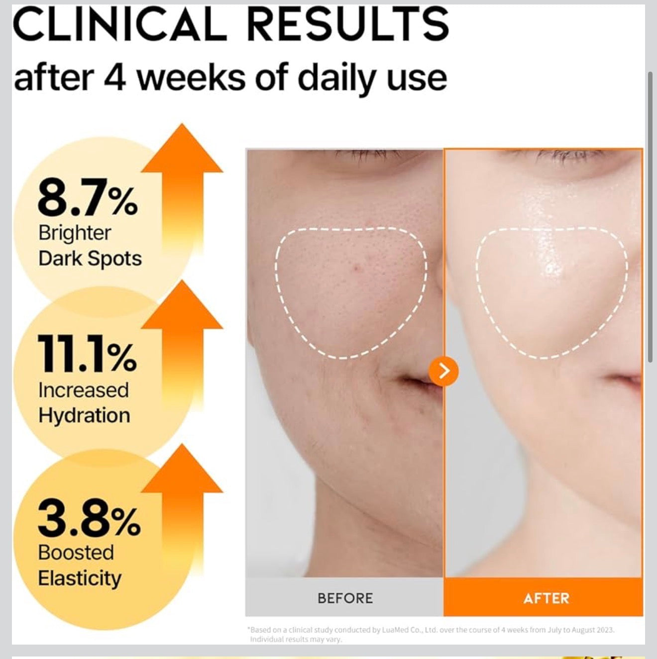 DARK SPOT
VITAMIN C SERUM