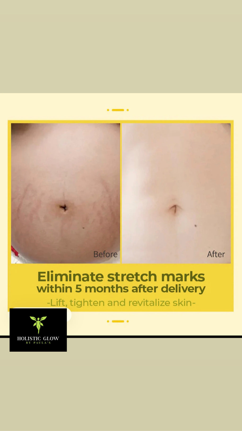 Olive Smoothing oil for stretch marks.
150ml