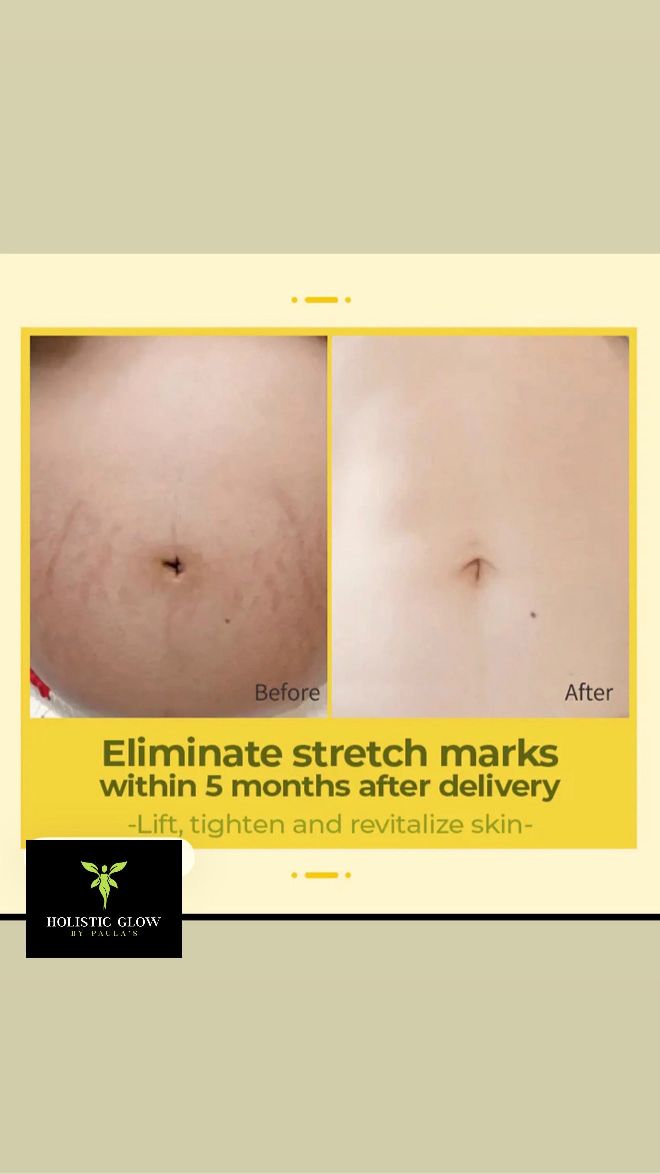 Olive Smoothing oil for stretch marks.
150ml