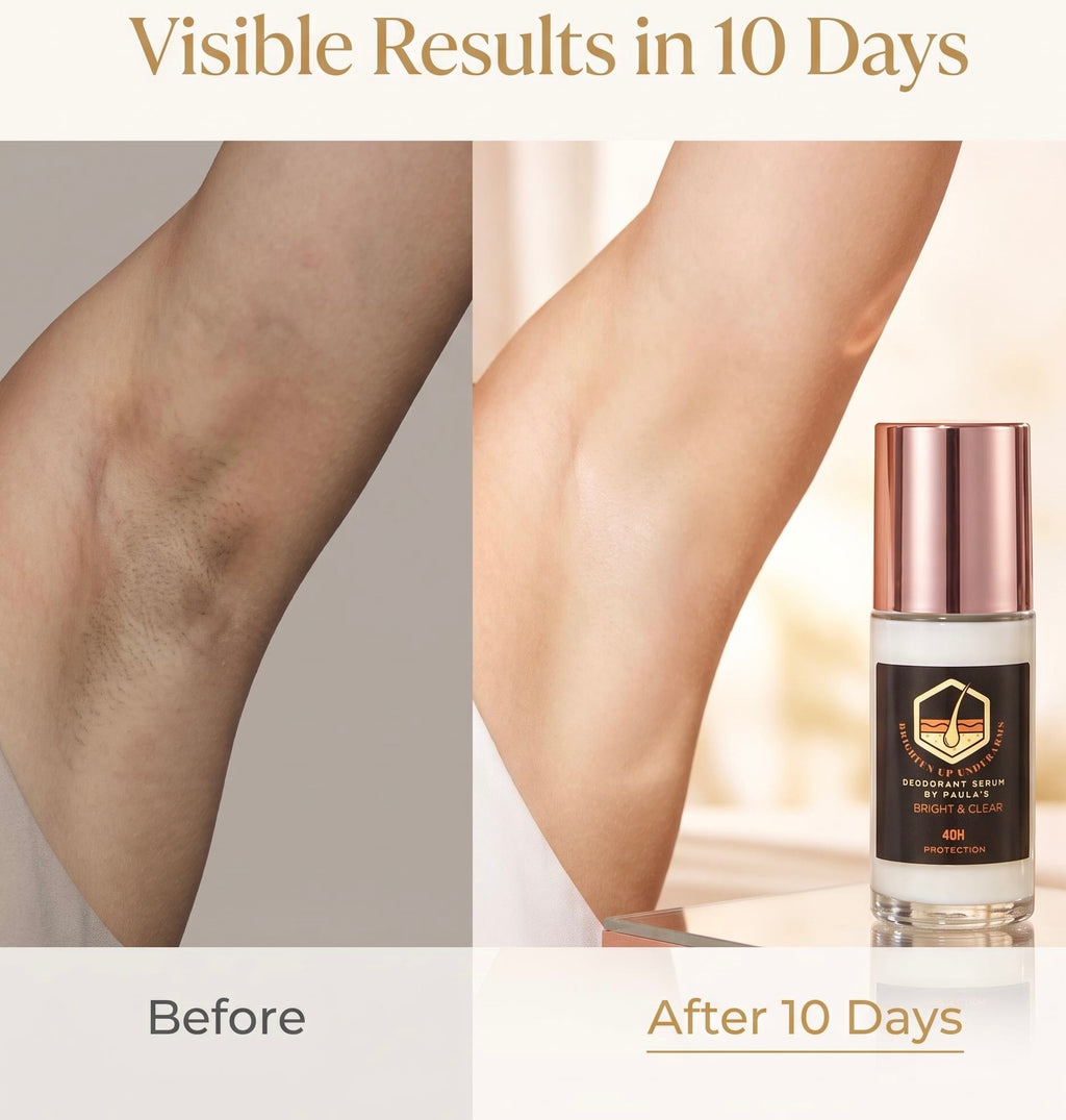 Before-and-after comparison showing leg hair reduction over 10 days, with a hair removal serum bottle displayed on the right side under the text 'Visible Results in 10 Days'.