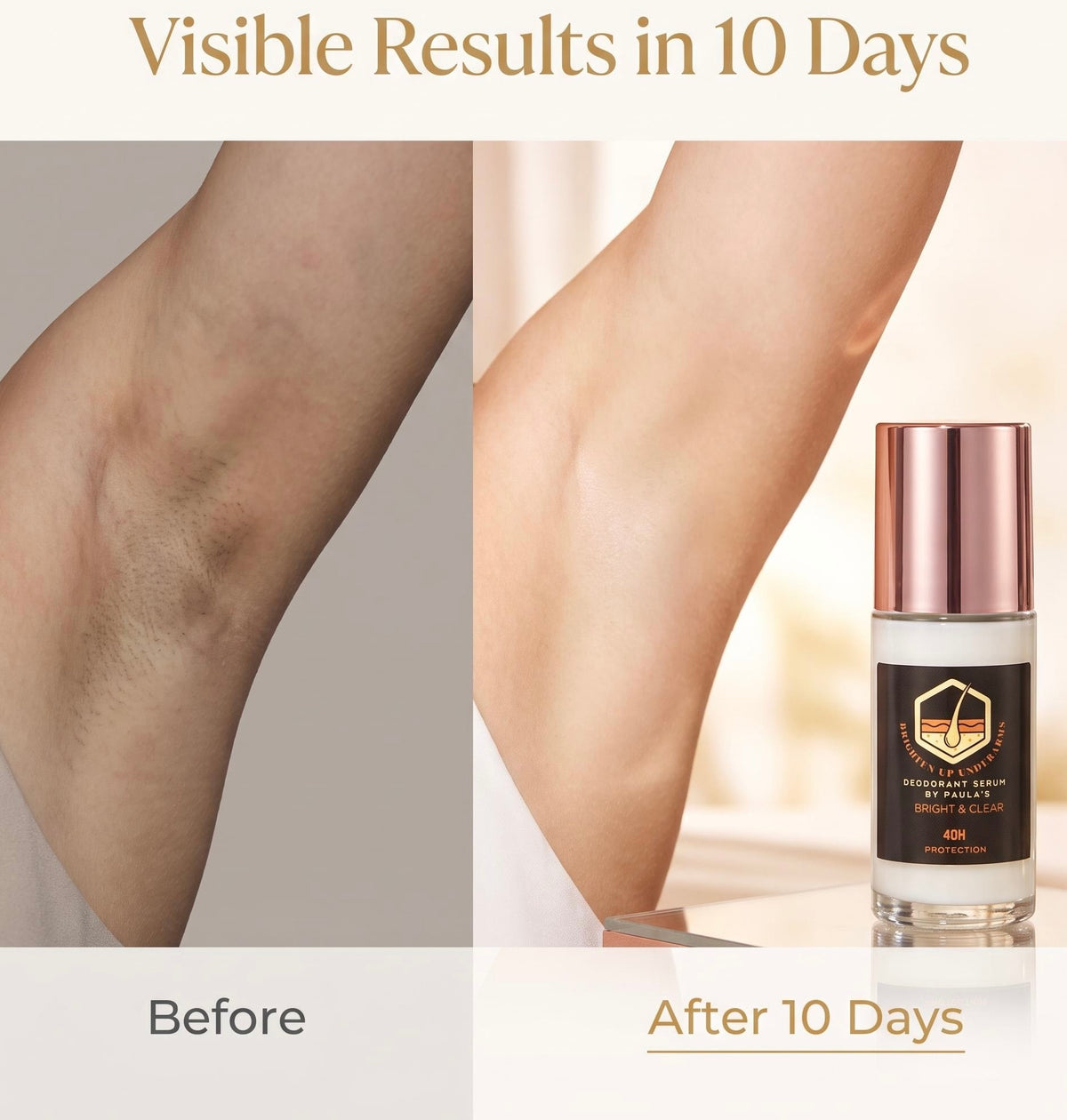 Before-and-after comparison showing leg hair reduction over 10 days, with a hair removal serum bottle displayed on the right side under the text 'Visible Results in 10 Days'.