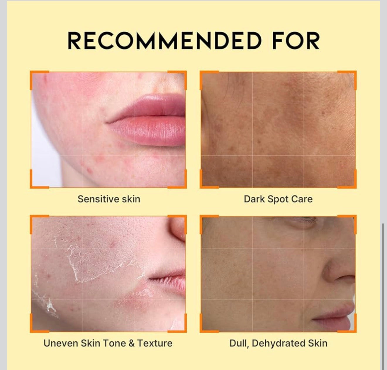 DARK SPOT
VITAMIN C SERUM