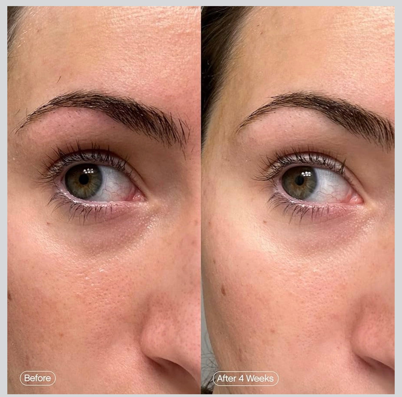 Topicals Faded Brightening Under Eye Masks.